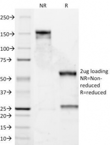 SDS-PAGE Analysis of Purified, BSA-Free Cyclin D1 Antibody (DCS-6). Confirmation of Integrity and Purity of the Antibody