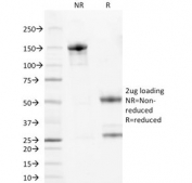 SDS-PAGE analysis of purified, BSA-free Bcl-2 antibody (clone 100/D5) as confirmation of integrity and purity.