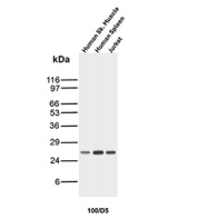 Bcl-2 Antibody WB. Western blot testing of human skeletal muscle, spleen and Jurkat lysate with Bcl-2 antibody (clone 100/D5).