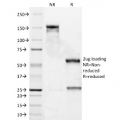 SDS-PAGE analysis of purified, BSA-free Bcl-2 antibody (clone 8C8) as confirmation of integrity and purity.