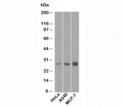 Bcl-2 antibody western blot
