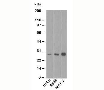 Western blot testing of human samples with Bcl-2 antibody (8C8).