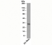 Western blot testing of human samples using Bcl-2 antibody (clone 124).