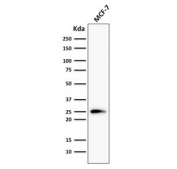 Western blot testing of human MCF7 cell lysate with Bcl-2 antibody (clone 124).