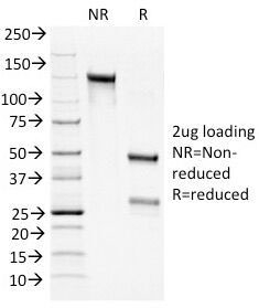 SDS-PAGE Analysis of Purified, BSA-Free Bcl2 Antibody cocktail (100/D5 + 124). Confirmation of Integrity and Purity of the Antibody.