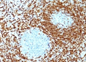 Bcl2 antibody immunohistochemistry