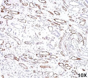 IHC testing of FFPE human kidney transplant tissue (10X) stained with C4d antibody (C4D204).