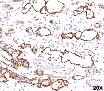 IHC testing of FFPE human kidney transplant tissue (20X) stained with C4d antibody (C4D204).