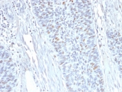 IHC staining of FFPE human endometrium with Cyclin A2 antibody (clone E67). HIER: boil tissue sections in pH 9 10mM Tris with 1mM EDTA for 20 min and allow to cool before testing.
