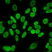 Immunofluorescent staining of PFA-fixed human HeLa cells with Cyclin B1 antibody (clone V92.1).