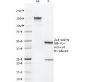 SDS-PAGE analysis of purified, BSA-free CD1a antibody (clone O10) as confirmation of integrity and purity.