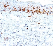 IHC testing of human skin stained with CD1a antibody (clone C1A/711).