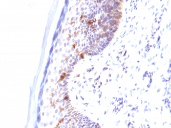 IHC testing of human skin stained with CD1a antibody (clone C1A/711).~