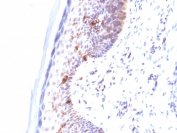IHC testing of human skin stained with CD1a antibody (clone C1A/711).