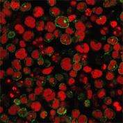 Immunofluorescent staining of human Molt-4 cells with CD2 antibody (clone 1E7E8.G4, green) and Reddot nuclear stain (red).