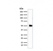 Western blot testing of human Jurkat cell lysate with CD2 antibody (clone 1E7E8.G4). Expected molecular weight: 38-50 kDa depending on level of glycosylation.