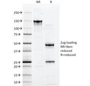 SDS-PAGE analysis of purified, BSA-free CD2 antibody (clone 1E7E8.G4) as confirmation of integrity and purity.