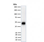 Western blot testing of human Jurkat cells with CD2 antibody (clone UMCD2). Expected molecular weight: 38-50 kDa depending on level of glycosylation.