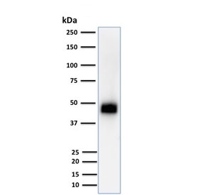Western blot testing of human Jurkat cells with CD2 antibody (clone UMCD2). Expected molecular weight ~47 kDa.