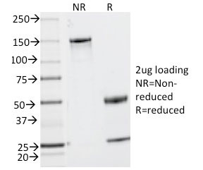 SDS-PAGE analysis of purified, BSA-free CD2 antibody (clone UMCD2) as confirmation of integrity and purity.