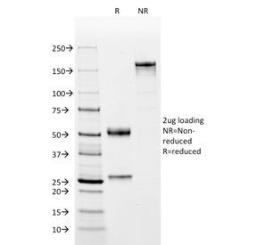 SDS-PAGE analysis of purified, BSA-free CD2 antibody (clone BH1) as confirmation of integrity and purity.