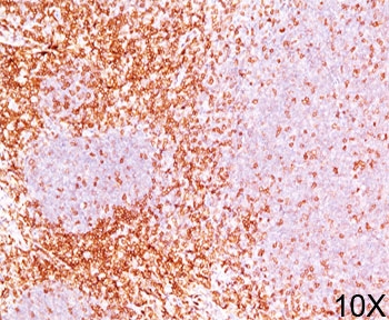 IHC testing of human tonsil stained with CD6 antibody (3F7B5).~