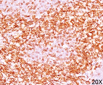 IHC testing of human tonsil (10X) stained with CD6 antibody (clone C6/372).