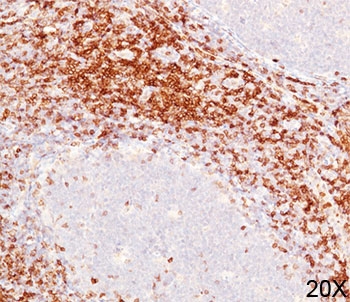 IHC testing of human tonsil (20X) stained with CD6 antibody (clone C6/372).