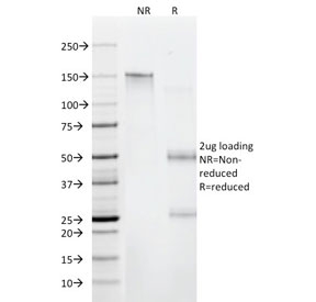 SDS-PAGE analysis of purified, BSA-free CD6 antibody (clone C6/372) as confirmation of integrity and purity.
