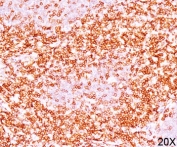 IHC testing of human tonsil (10X) stained with CD6 antibody (clone C6/372).