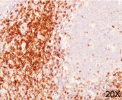 CD6 antibody immunohistochemistry 20X