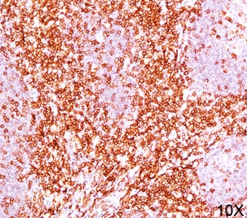 IHC testing of human tonsil (10X) stained with CD6 antibody cocktail (C6/372 + 3F7B5).