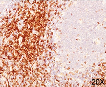 IHC testing of human tonsil (20X) stained with CD6 antibody cocktail (C6/372 + 3F7B5).