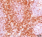 CD6 antibody immunohistochemistry 10X