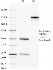 SDS-PAGE analysis of purified, BSA-free CD8a antibody (clone C8/468) as confirmation of integrity and purity.