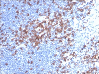 IHC staining of FFPE human lymph node tissue with CD8a antibody (clone C8/468). HIER: boil tissue sections in pH 9 10mM Tris with 1mM EDTA for 20 min and allow to cool before testing.