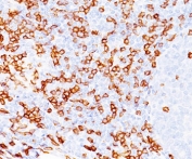 IHC testing of FFPE human tonsil (20X) stained with CD8a antibody (C8/468). Note cell surface staining.