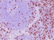 IHC staining of FFPE human tonsil tissue with CD8a antibody (clone C8/468). HIER: boil tissue sections in pH 9 10mM Tris with 1mM EDTA for 20 min and allow to cool before testing.