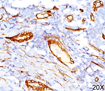 IHC testing of human tonsil (20X) stained with CD34 antibody (QBEnd/10).