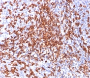 IHC testing of FFPE human tonsil stained with HCAM antibody (clone 156-3C11).