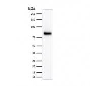 Western blot testing of HeLa cell lysate with HCAM antibody (clone 156-3C11). Predicted molecular weight ~81 kDa.