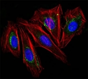 Immunofluorescence testing of HeLa cells with Alexa Fluor 488 conjugated CD63 antibody (green). F-actin filaments are labeled with Dylight 554 phalloidin (red); nuclei stained with DAPI (blue).