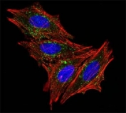 Immunofluorescence testing of HeLa cells with Alexa Fluor 488 conjugated CD63 antibody (green). F-actin filaments are labeled with Dylight 554 phalloidin (red); nuclei stained with DAPI (blue).