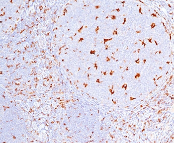 IHC testing of human tonsil (10X) stained with CD68 antibody (C68/684).~