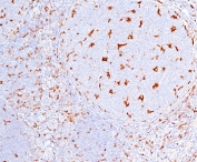 CD68 antibody C68/684 immunohistochemistry tonsil