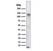 Western blot testing of human spleen lysate with CD68 antibody (clone C68/684). Expected molecular weight: 37-110 kDa depending on glycosylation level.