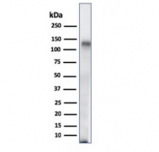 Western blot testing of human spleen lysate with CD68 antibody (clone C68/684). Expected molecular weight: 37-110 kDa depending on glycosylation level.