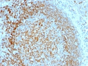 IHC staining of FFPE human tonsil tissue with CD74 antibody (clone LN-2). HIER: boil tissue sections in pH 9 10mM Tris with 1mM EDTA for 20 min and allow to cool before testing.
