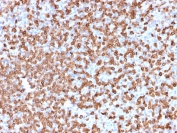 IHC staining of FFPE human spleen tissue with CD74 antibody (clone LN-2). HIER: boil tissue sections in pH 9 10mM Tris with 1mM EDTA for 20 min and allow to cool before testing.