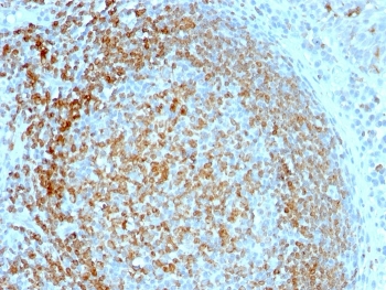 IHC staining of FFPE human tonsil tissue with CD74 antibod